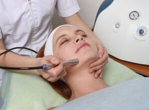Rajeunissement au laser du visage