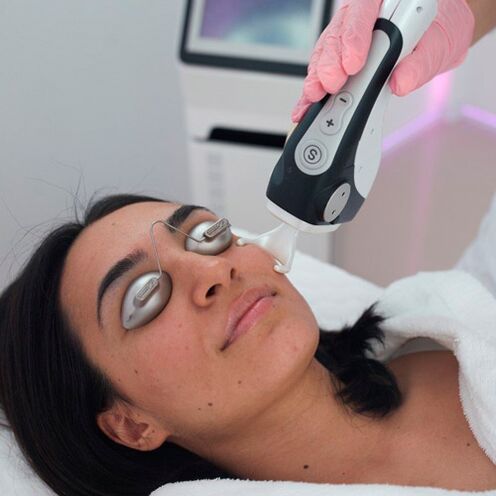 Traitement de la peau du visage avec laser fractionné
